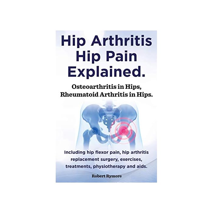 Buy Hip Arthritis, Hip Pain Explained. Osteoarthritis in Hips