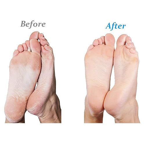 Miniatura 4 de Emjoi Micro-Pedi - Rodillos de repuesto (extra gruesos) - Paquete de 4