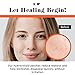 No BS Healing Acne Patches - Hydrocolloid, Acne Spot and Pimple Treatment to Prevent Acne Scars. Invisible On All Skin Tones (1 BOX of 72ct)