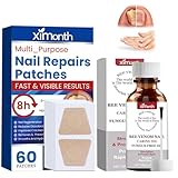 60PCS Nagelgraben Reparaturpflaster, 15ML Nagelweicher fußnägel, Spaltnagelreparatur Stärkende Nägel, Nagelgraben Reparaturpflaster für Beschädigte Nägel und das Erscheinungsbild Verfärbter Nägel
