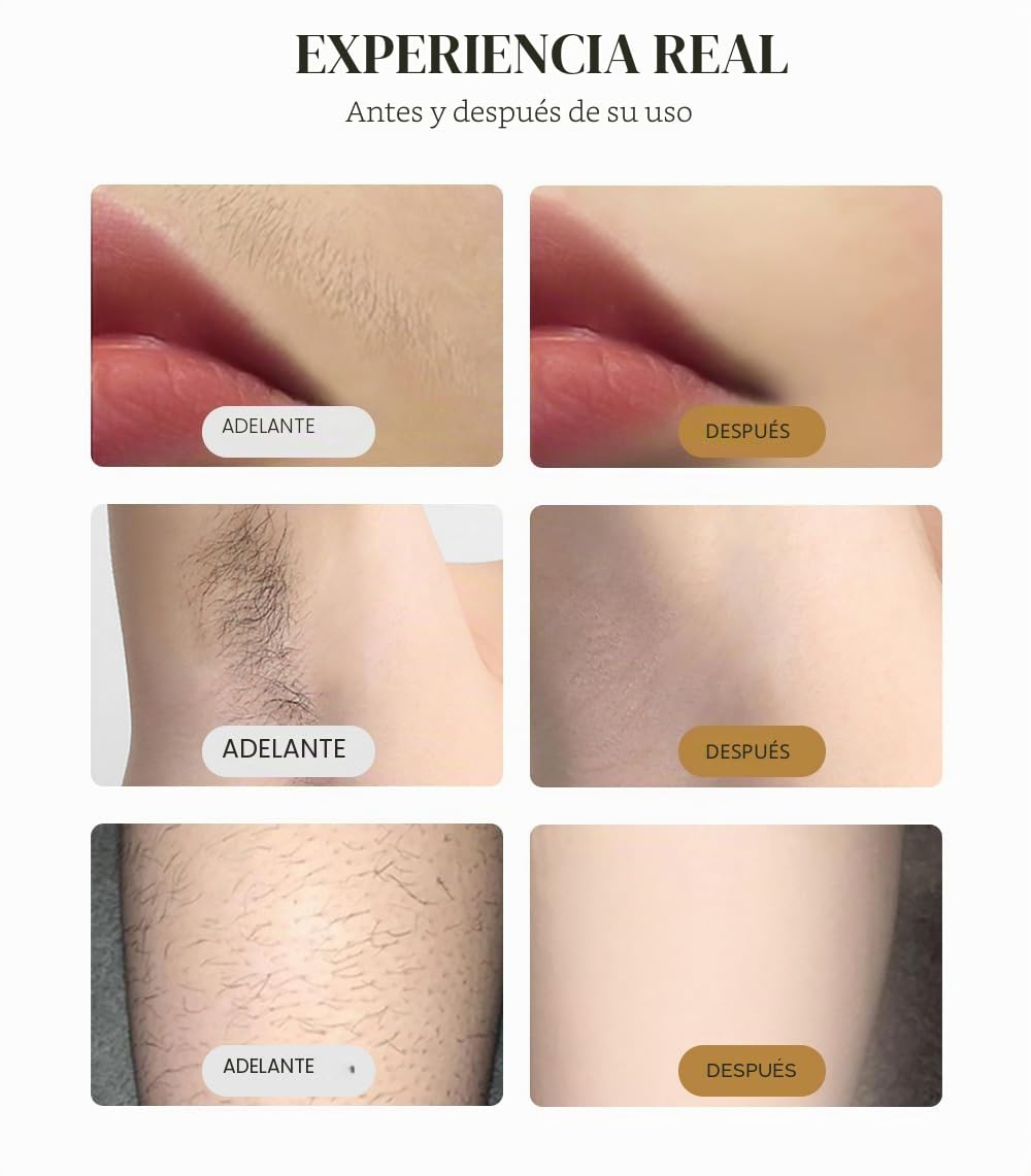 Tecnología de enfriamiento del punto de congelación de la máquina profesional de depilación láser de diodos de 4 longitudes de onda de 808 nm 4000w Salón de belleza de depilación permanente disponible
