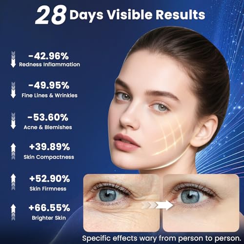 Red Light Therapy for Face – Wireless Red Light Therapy Mask LED Face Mask Light Therapy with 320 LEDs, 3 Modes, Skin Rejuvenation, Anti-Aging Skincare Ideal Beauty Gift for Women & Men