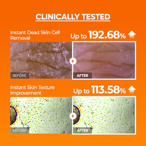 Image of Dr.Melaxin Peel Shot Mela-C.E Ferulic Serum Dead Skin Cells, Dullness & Uneven Texture, Vitamin C.E + Ferulic Acid, Retinar X, Korean Brightening Exfoliating Treatment, 2.70 fl. oz, 80ml