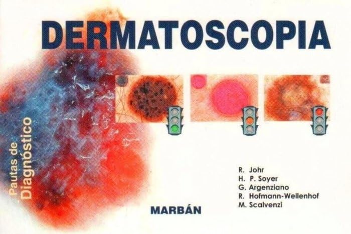 Dermatoscopia. Pautas de diagnostico