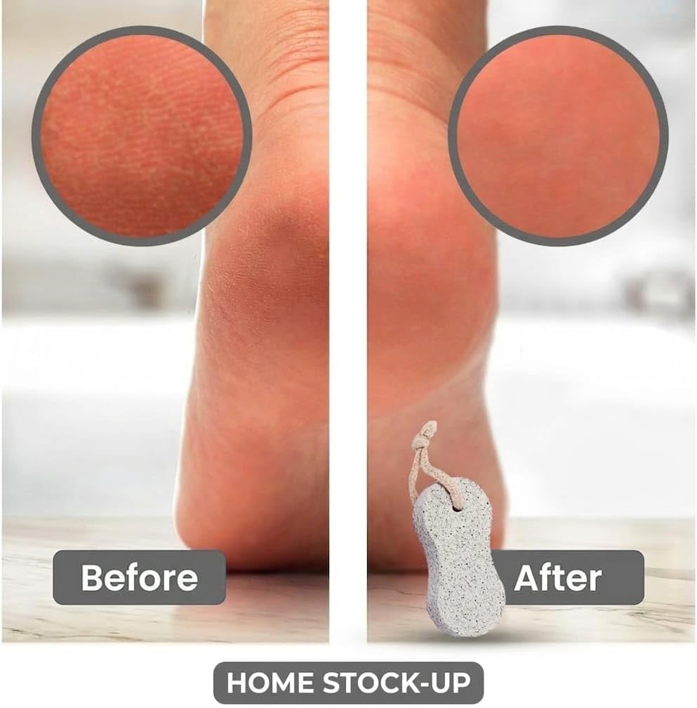 Pumice Stone Pack of 2 Natural Volcanic Stones for Gentle Exfoliation, Callus and Dead Skin Removal, Safe for Feet and Hands