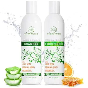 Products For Scalp Eczema