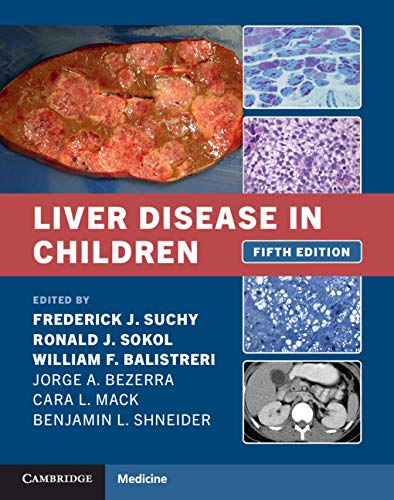 Liver Disease in Children Liver Disease in Children