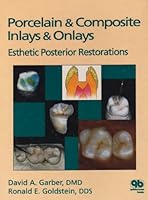 Porcelain & Composite Inlays & Onlays: Esthetic Posterior Restorations 0867151714 Book Cover
