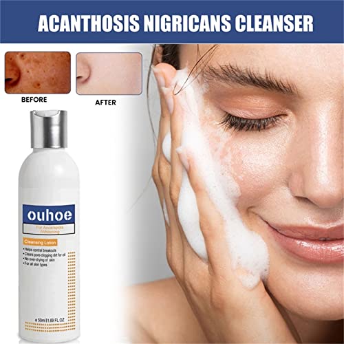 Cleansing Lotion For Acne & Spots & Acanthosis Nigricans, Salyzap Body Wash, Nigrifree Acanthosis Nigricans Therapy Cream, Acanthosis Nigricans Therapy Oil For All Skin Types, 50Ml #TOP1