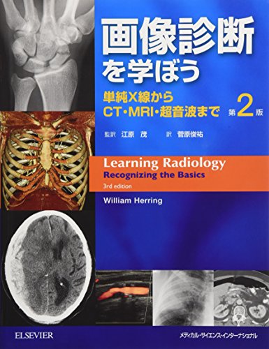 キンドル 無料電子書籍 画像診断を学ぼう 単純X線からCT・MRI・超音波まで 第2版 バイ