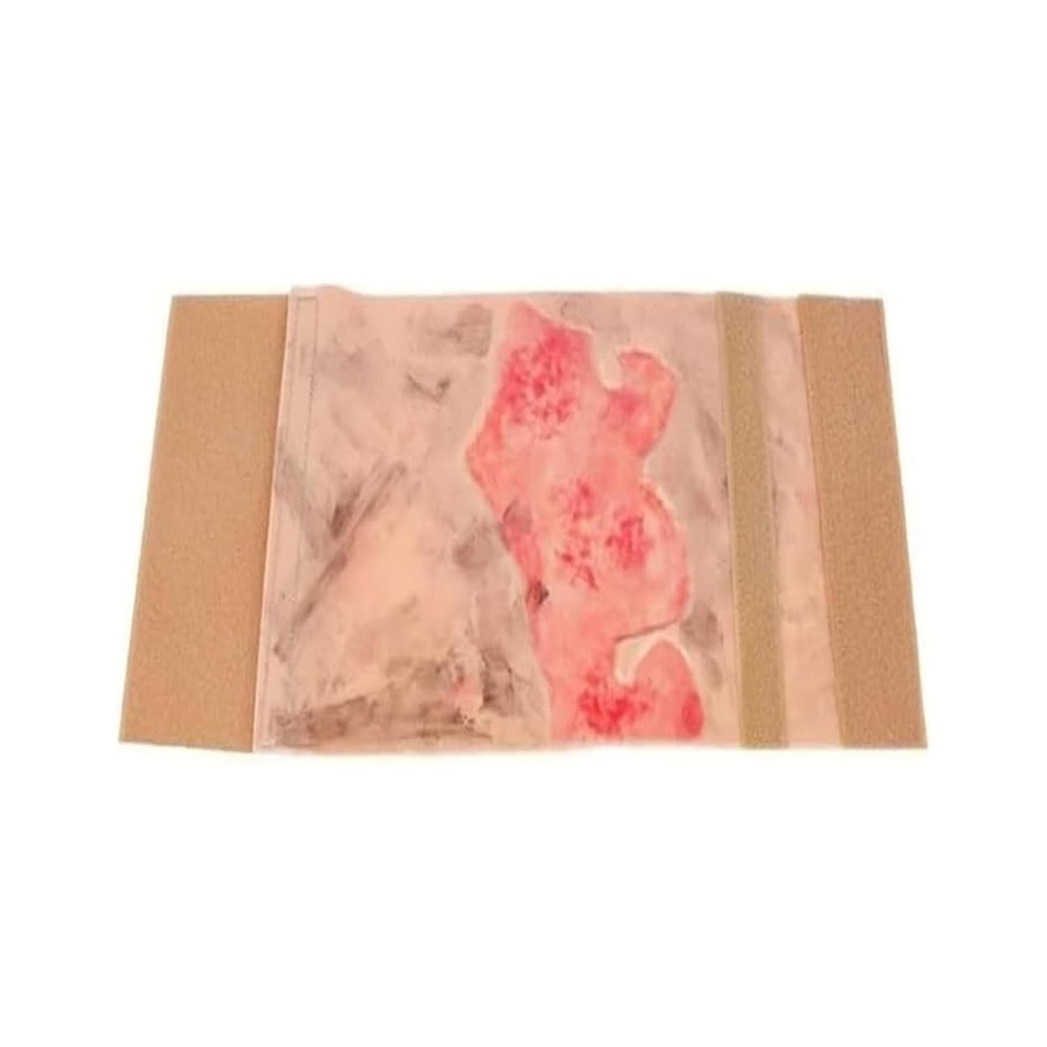Burn Wound Model, Wearable Silicone Limb Burns Simulator | Burns Training Module,with Second and Third Degree Simulated Burnsfor Assessment, Debridement, Packing and Dressing Practice