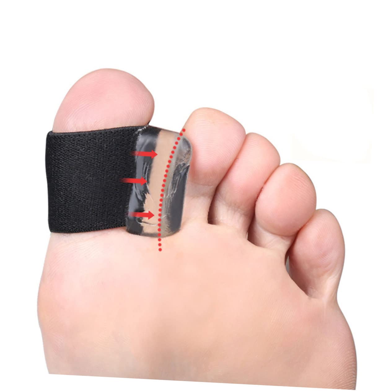 HAPINARY Separator Orthotic for Hallux Separators for Men for Overlapping Bunions