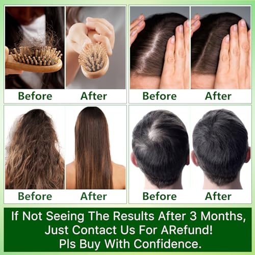 Hair Growth Shampoo and Conditioner Sets w/6 in 1 Heat Protectant Spray,Rosemary Oil Biotin Keratin Caffeine Sulfate Free Hair Thickening Products for Thinning Hair & Hair Loss,Gifts for Women Men - Image 7