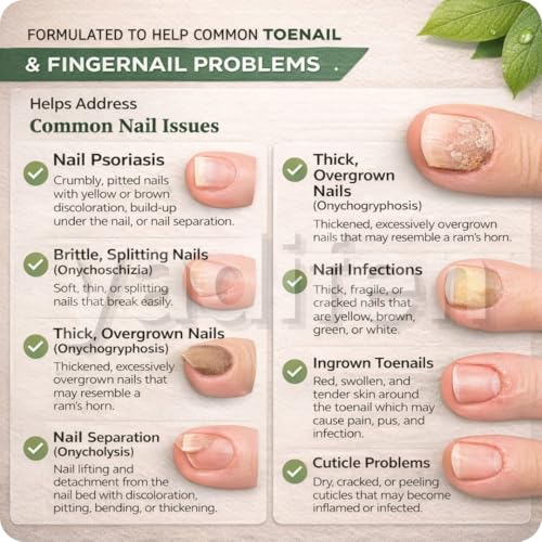 Image of Nail Fungal Repair Oil - Fungus Remover Infection Medicine Serum Treatment, Toenail Drops Liquid for Damaged Nails (30ML, 1, count)