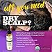 Organic Anti-itch Scalp Treatment, Soothing and Nourishing Treatment for Dry, Flaky Scalps, Anti-Dandruff Scalp Oil Enriched with Tea Tree, Lavender and Rosemary Oil, 2oz