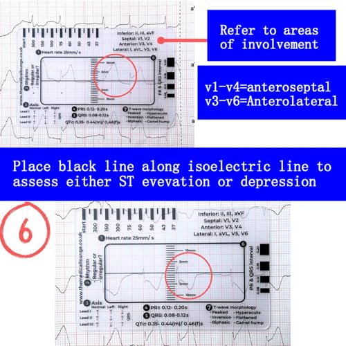 Reglas de ECG de 7 pasos para el bolsillo de la bata en pases de guardia 7