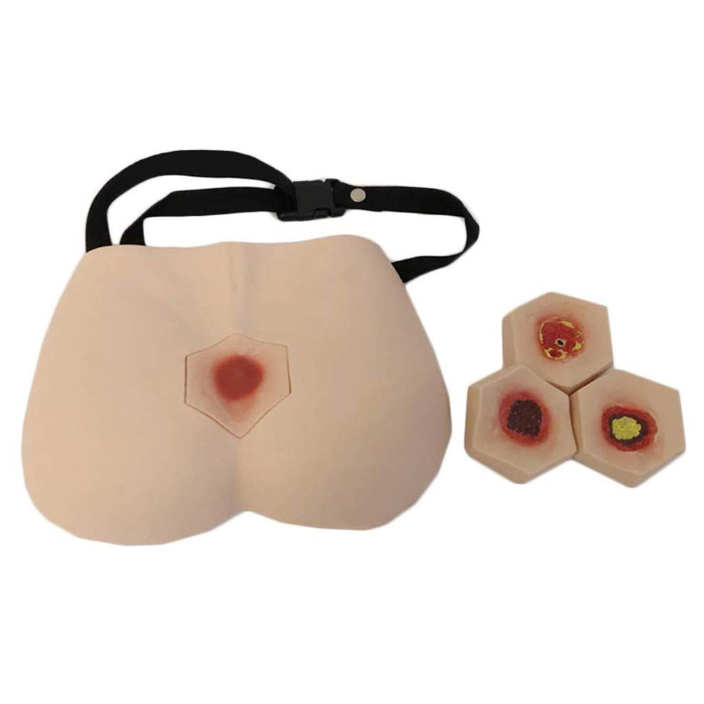 Buy LUCKFY 4 Stages Of Bedsores Decubitus Ulcer Care Model Pressure 