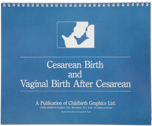 Image of HEALTH EDCO W43156 Cesarean Birth and Vaginal Birth After Cesarean Flip Chart, 10-1 /2 inch Length x 8-1 /2 inch Height