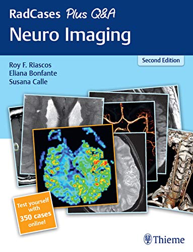 RadCases Plus Q&A: Neuro Imaging
