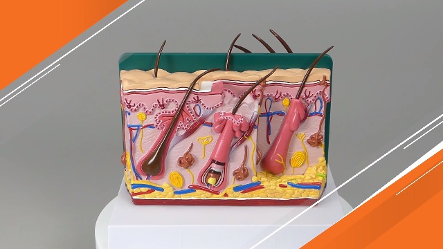 Image of GPI Anatomicals Aging Skin and Hair Loss Model, Replica Showing Aging Skin
