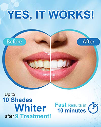 mysmile non-sensitive teeth whitening pen mint gel enamel safety 8ml 30 treatments fast remove 20 years of stains care oral bright smile alternative teeth whitening strips