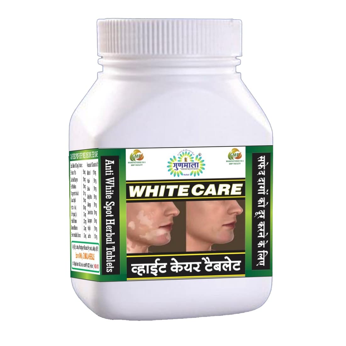 GUNMALA Herbal Whitecare Tablets-100 Tablet(Vitiligo Care) (B0BZLN5555) Amazon Price History, Amazon Price Tracker