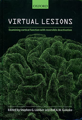 Virtual Lesions: Examining Cortical Function With Reversible Deactivation view 2