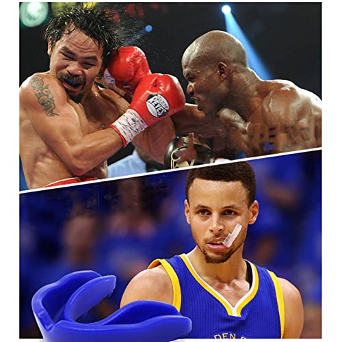 2 Pezzi di Protezione per la Bocca, Paradenti