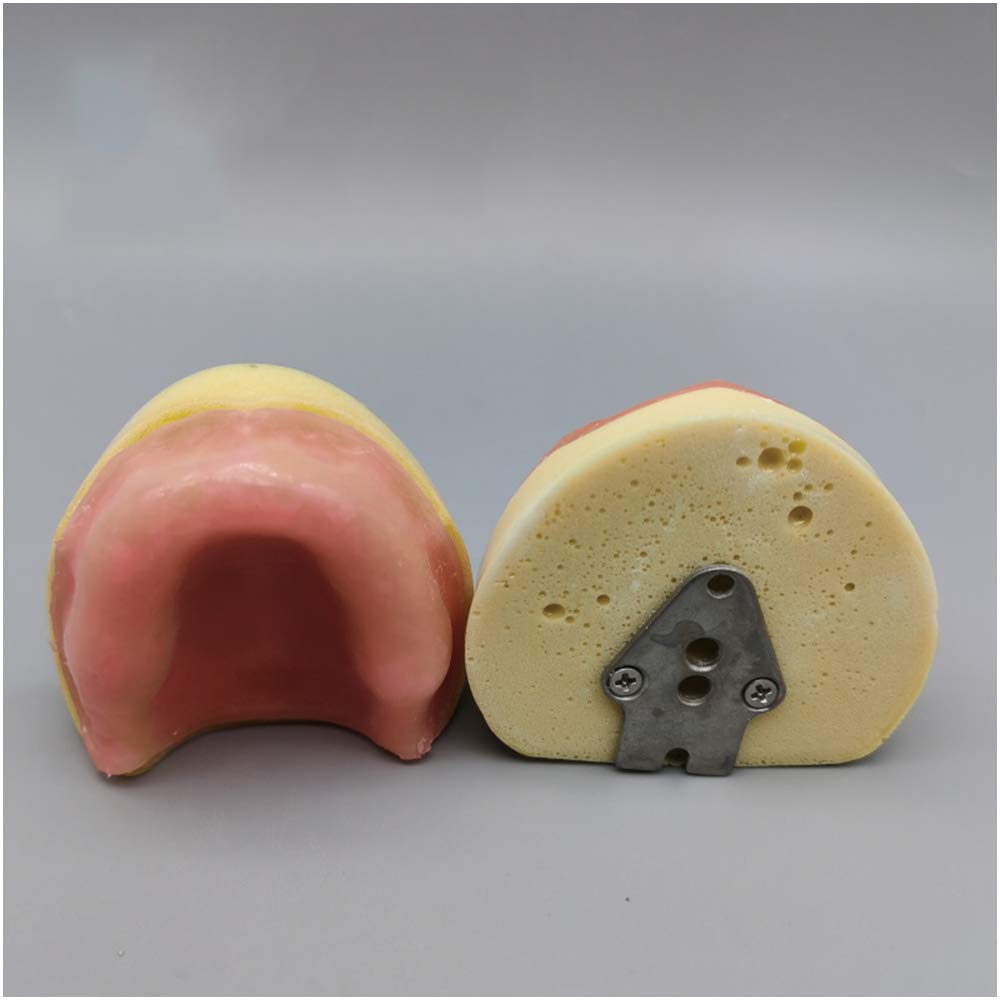 Modèle De Pratique De L'implant Dentaire - sans Gencives Modèle D'implant Oral Dentaire - Gommes en Silicone Douce pour Mâchoires Édentées - Pratique pour Les Étudiants
