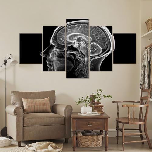 5 Pcs Canvas Wall Art mri brain human head brain pictures Photo Prints Realism Stretched and Framed Artworks Modern Wall Decor for Living Room Bedroom Office