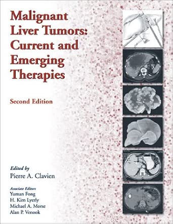 Malignant Liver Tumors: Current and Emerging Therapies: . 2nd Edition book cover