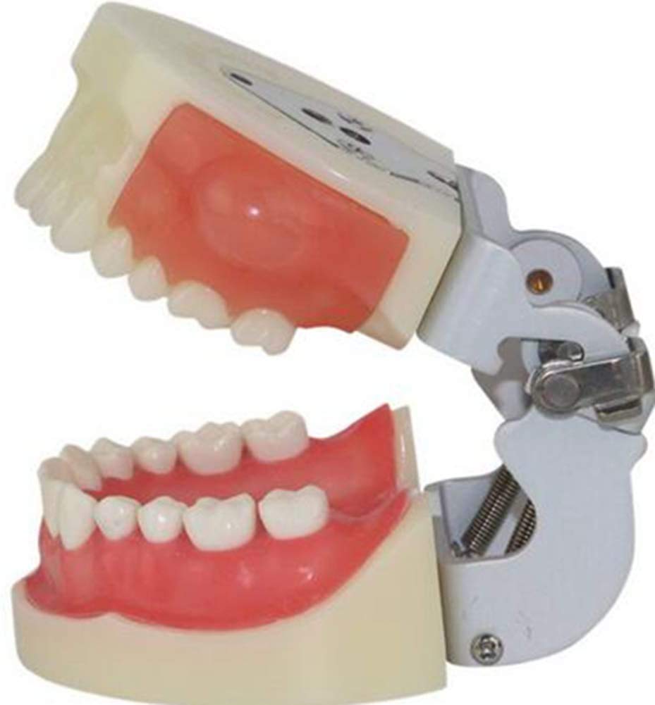 Apparecchiature Mediche Dentali Orali Modello di Preparazione Dentale per Incisione E Drenaggio Dell'Ascesso per Studenti, Insegnanti E Professionisti