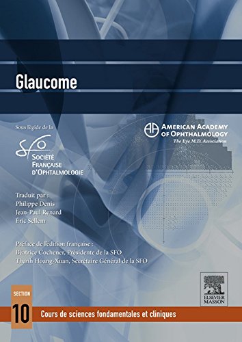 Télécharger Glaucome PDF