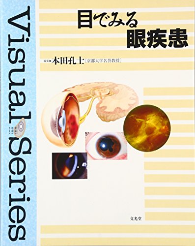 無料電子書籍 pdf 目でみる眼疾患 (Visual series) バイ