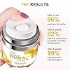 Vitamin-C-Intense-Night-Cream-Daily-Anti-Aging-Moisturizer-Cream-for-Face-Reduce-Appearance-of-Wrinkles-Fine-Lines-dark-circles-17FLOZ Vitamin C Intense Night Cream , Wrinkle Cream for Face with Retinol, Daily Anti Aging Moisturizer Cream for Face…