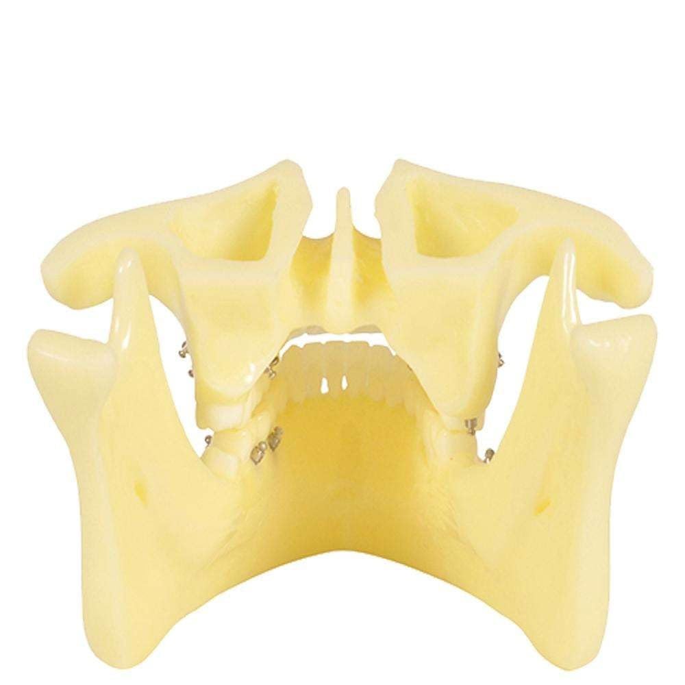 Modello dentale di base per la formazione sull'implantologia, a scopo didattico per studi odontoiatrici e ricerca medica.