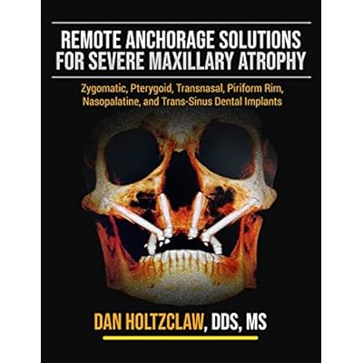 Remote Anchorage Solutions for Severe Maxillary Atrophy
