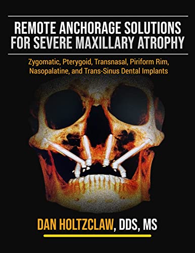 Remote Anchorage Solutions for Severe Maxillary Atrophy: Zygomatic Implants, Pterygoid Implants, Transnasal Implants, Piriform Rim Implants, Nasopalatine Implants, and Trans Sinus Dental Implants