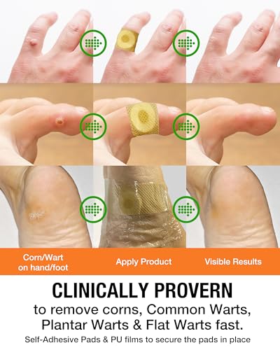 Wart Corn Remover Pads for Feet: 42 Pack 40% Salicylic Acid Extra Strength Bandages for Plantar Warts Corns Small Callus on Feet Hands Toes - Safe Effective Treatment for Adults Children