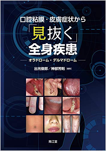 無料電子書籍 pdf 口腔粘膜・皮膚症状から「見抜く」全身疾患: オラドローム,デルマドロー バイ