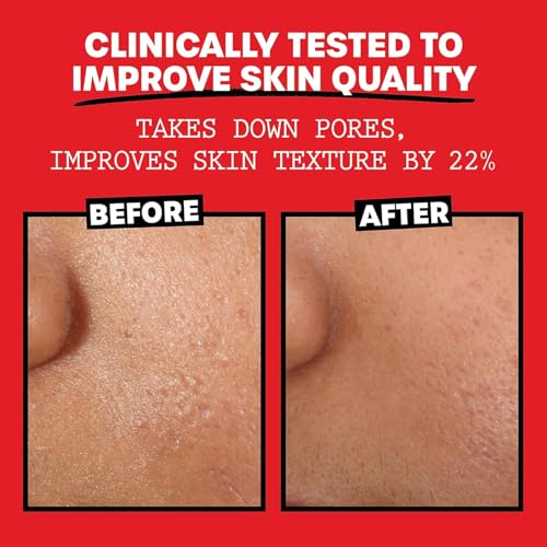 Image of THAYERS Alcohol-Free, Hydrating, Unscented Witch Hazel Facial Toner with Aloe Vera Formula, Vegan, Dermatologist Tested and Recommended, 12 Oz (Pack of 2)