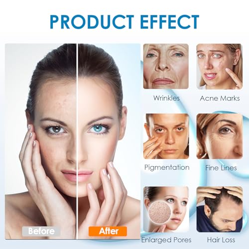 Dr. pen A11/A9/M8S/A8S Cartridges Nano-S – 15 Stück für Hautpflege, tägliche Pflege und Serum-Absorption – Authentische Dr. pen Ersatzpatronen (15 Stück, Nano-S für A11/A9/M8S/A8S)