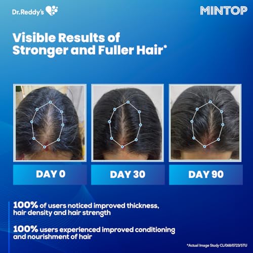 Image of Mintop Pro Plus| Hair Regrowth Serum by Dr Reddys|Fortified with Redensyl, Procapil, Biotin and Copexil| Proven Hair Fall Control| Scalp Nutrition| 50 Ml
