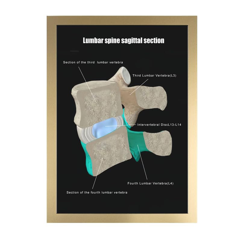 Image of Taanfu Body Educational Learning Anatomy Posters ，Lumbar Plane Art Lumbar Villi Anatomy Art Poster Digestive System Organs Illustration Small Intestine Physiology Anatomy Wall Art Villi