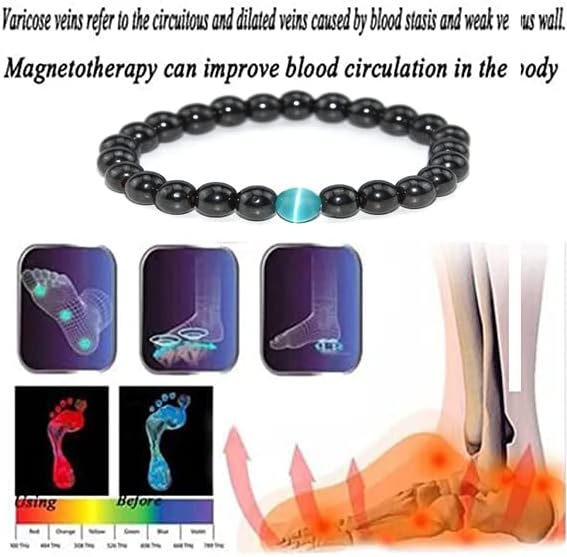 Miniatura 3 de Tobillera de obsidiana negra antihinchazón para mujer, pulsera de obsidiana de drenaje linfático, pulsera magnética de obsidiana antiansiedad para