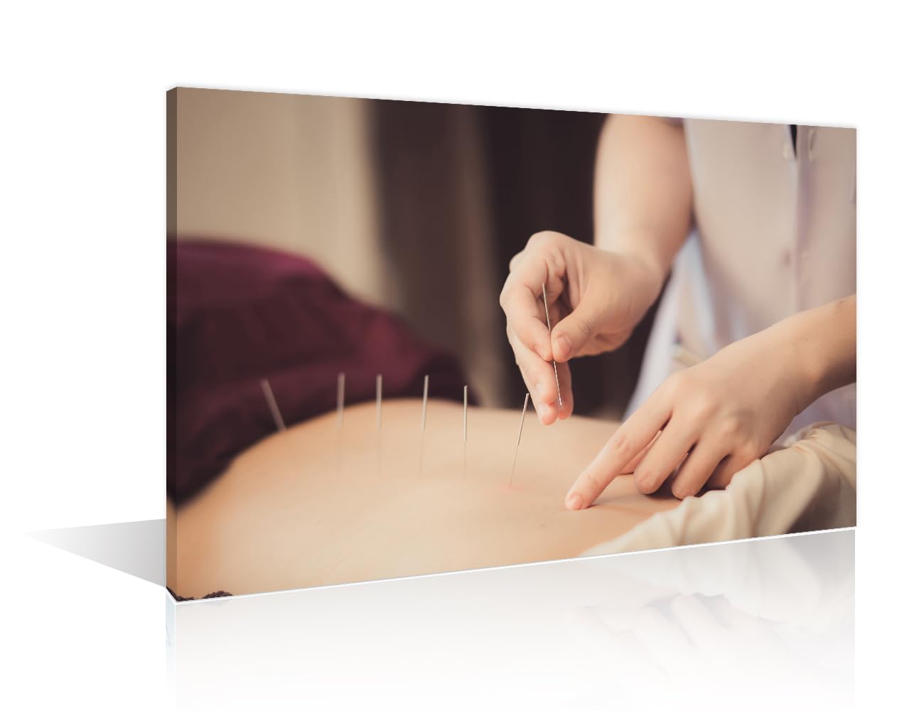 TUMOVO 1 Panels Acupuncture and Moxibustion Large Wall Art Traditional Chinese Medicine Wall Art for Living Room Traditional Art Prints Giclee Print Stretched and Framed Ready to Hang (24" Wx36 H)