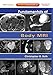 Fundamentals of Body MRI: Expert Consult- Online and Print (Fundamentals of Radiology)