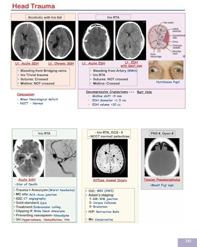 Image of Core BTR 3.0 Official Annotated Notes Vol 1, 2, 3 Complete Set | Digital HD Colour Medical Notes for NEET PG / INI-CET / FMGE 2026-2027....