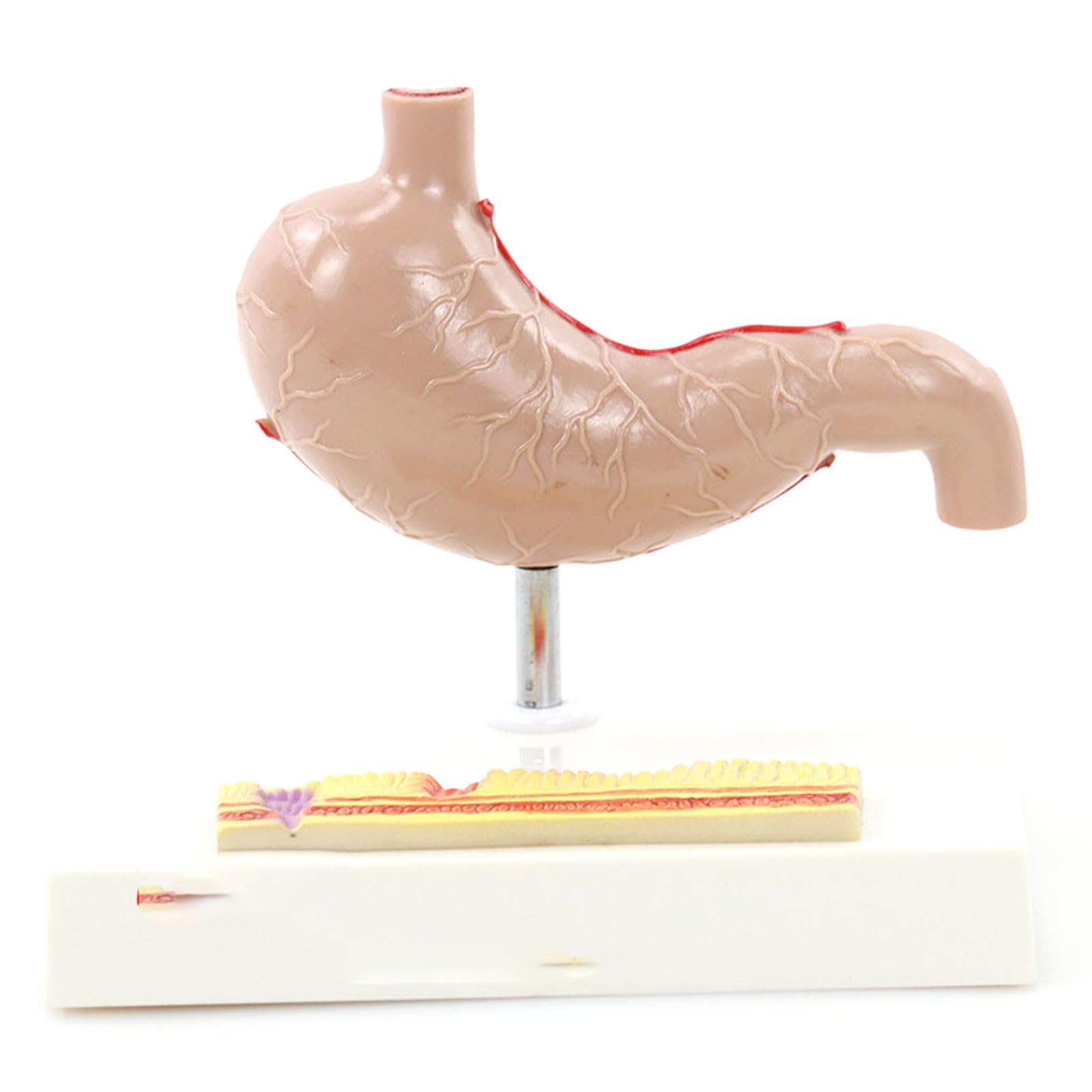 Modelo anatomía estómago tamaño Natural - Modelo anatómico órganos Humanos - Modelo estómago anatómico patológico médico - Modelo Esqueleto para Estudio, exhibición y enseñanza