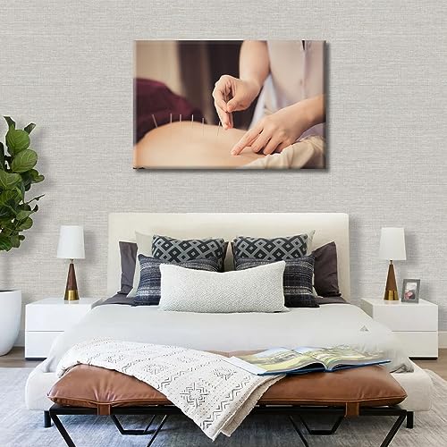 Image of TUMOVO 1 Panels Acupuncture and Moxibustion Large Wall Art Traditional Chinese Medicine Wall Art for Living Room Traditional Art Prints Giclee Print Stretched and Framed Ready to Hang (24 inch Wx36 H)